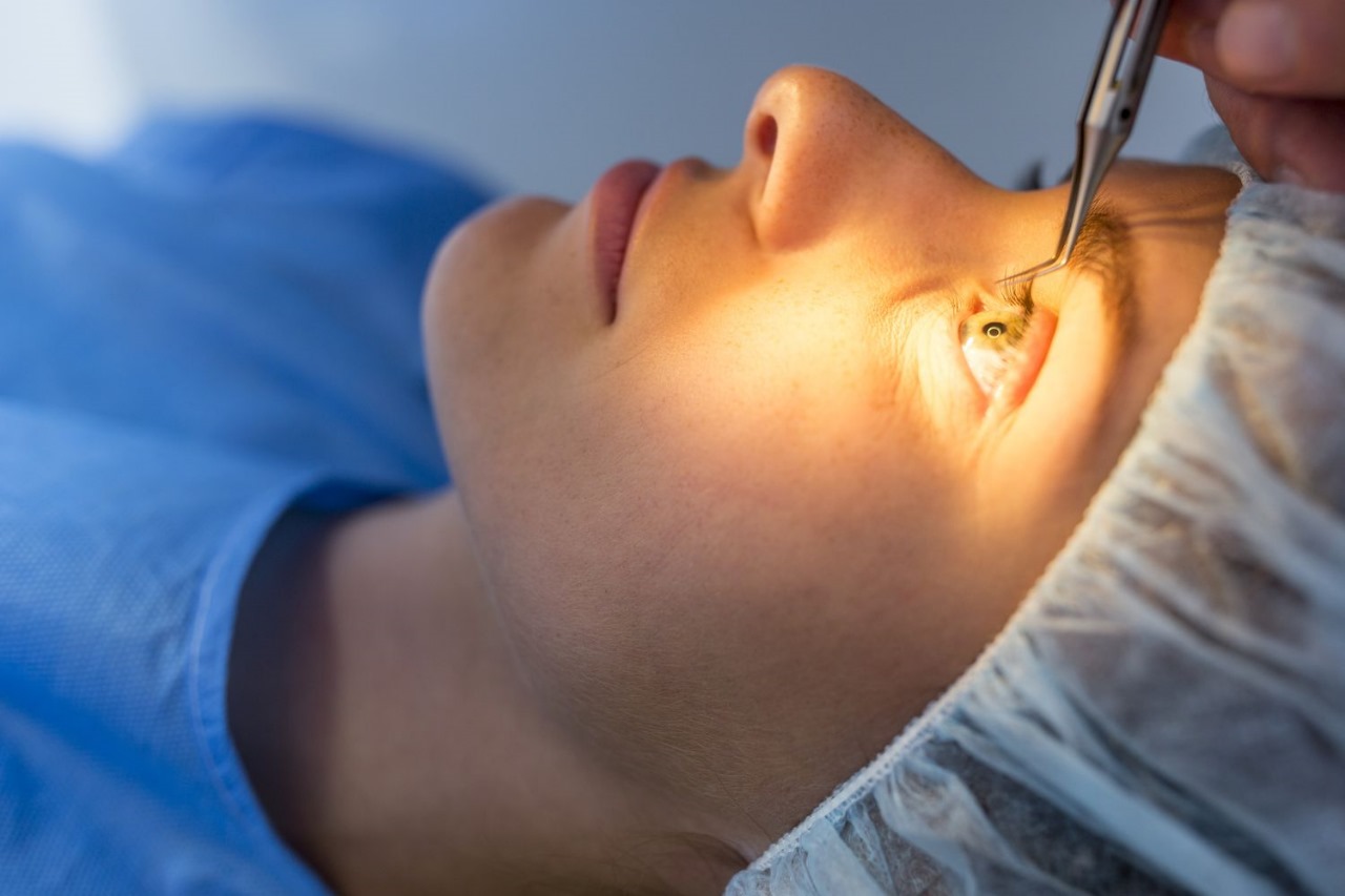 Book Your Surgery Today and Lock in the Best Lasik Turkey Price