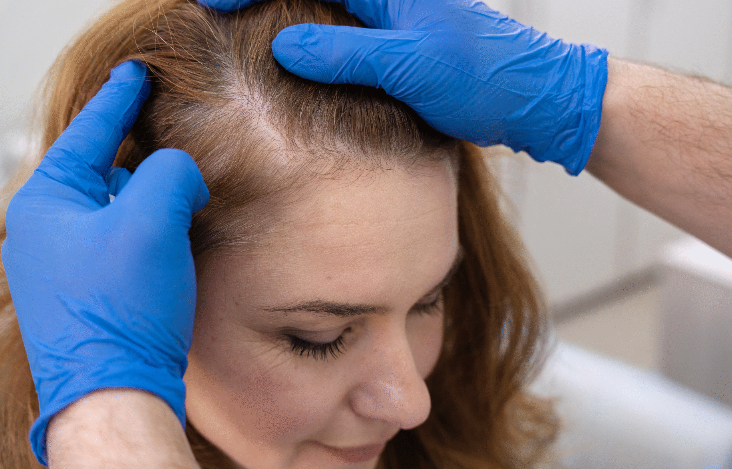Turkey Hair Transplant Cost Breakdown for 2026
